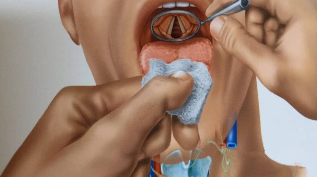 Gesang und Trauma, Marion Willmanns